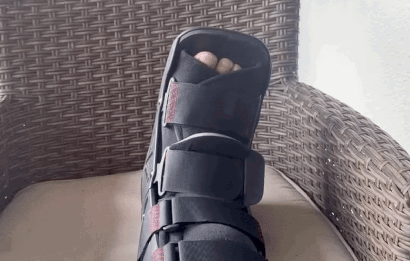 Bishop's leg in an ankle brace