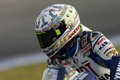 Picture exclusive: Jonny Rea's mangled finger